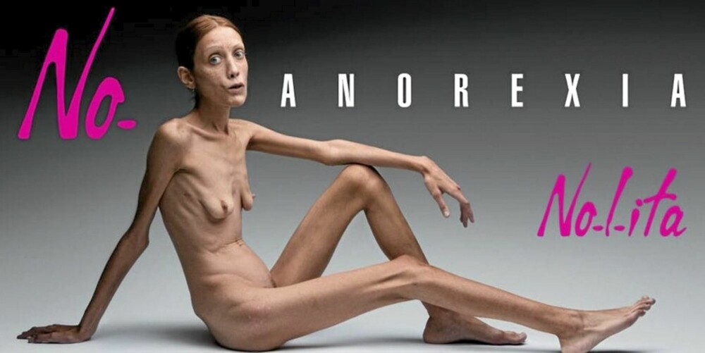 BANNLYSTE REKLAMER: Denne anorektiske modellen veier bare 30 kilo, og skapte voldsom oppstandelse under moteuka i Milano i 2007. BANNLYSTE REKLAMER: Denne anorektiske modellen veier bare 30 kilo, og skapte voldsom oppstandelse under moteuka i Milano i 2007.