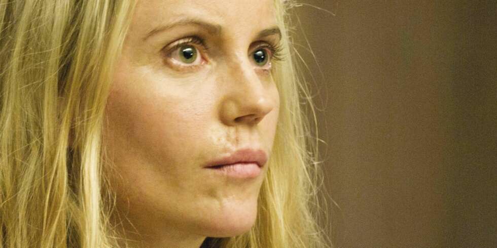 SYNLIGE ARR: I dag er det kun arret over overleppen og på høyre side av haken som er synlige tegn etter sykkelulykken Sofia Helin opplevde for 15 år siden. SYNLIGE ARR: I dag er det kun arret over overleppen og på høyre side av haken som er synlige tegn etter sykkelulykken Sofia Helin opplevde for 15 år siden.