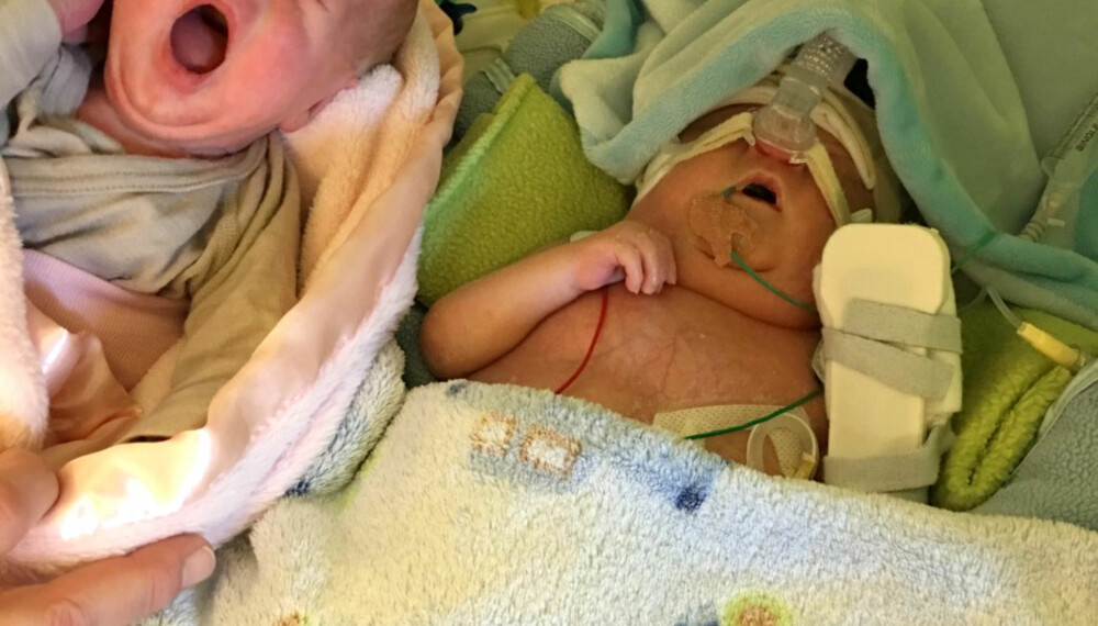 MØTE: Linneah får møte tvillingbror William for første gang. Kontakten mellom dem var påtagelig. FOTO: Privat MØTE: Linneah får møte tvillingbror William for første gang. Kontakten mellom dem var påtagelig. FOTO: Privat