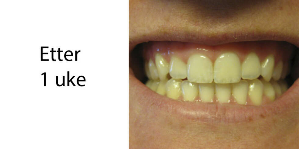 1 UKE: Resultate etter første uke. 1 UKE: Resultate etter første uke.