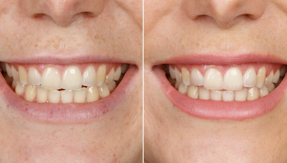 TEST AV TANNKREM: Oral-B 3D White LUXE. FOTO: Petter Berg TEST AV TANNKREM: Oral-B 3D White LUXE. FOTO: Petter Berg