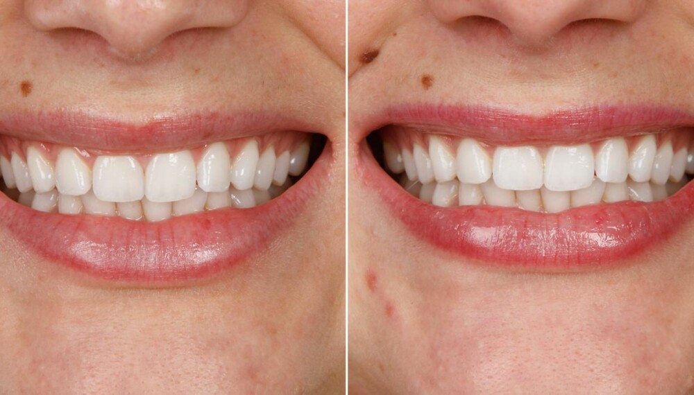 TEST AV TANNKREM: Pepsodent White Now. FOTO: Petter Berg TEST AV TANNKREM: Pepsodent White Now. FOTO: Petter Berg