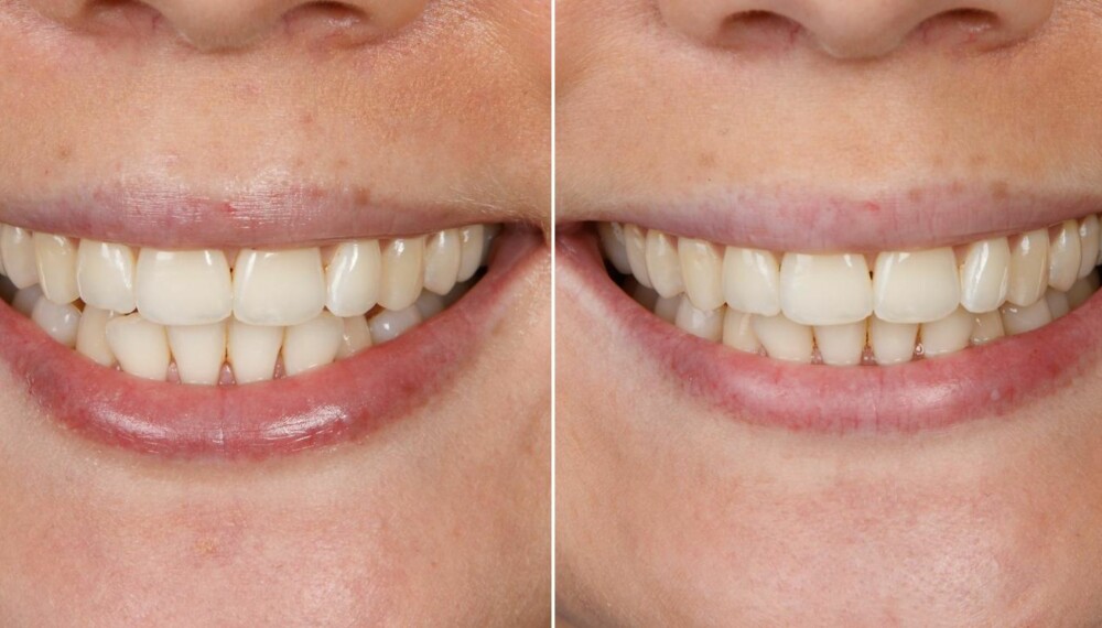 TEST AV TANNKREM: Colgate Max White. FOTO: Petter Berg TEST AV TANNKREM: Colgate Max White. FOTO: Petter Berg