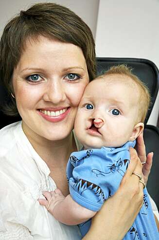 MOR OG SØNN: En stolt mamma Hanne med sønnen Marius - før operasjonene. MOR OG SØNN: En stolt mamma Hanne med sønnen Marius - før operasjonene.