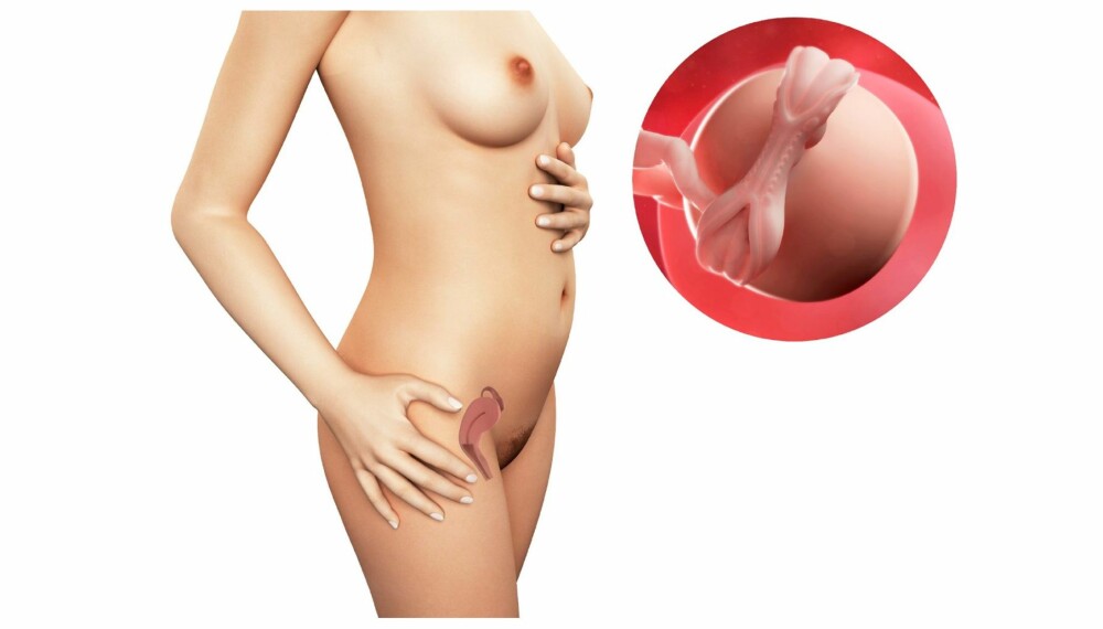 GRAVID UKE 5: Slik ser det ut i magen din etter fem uker. GRAVID UKE 5: Slik ser det ut i magen din etter fem uker.