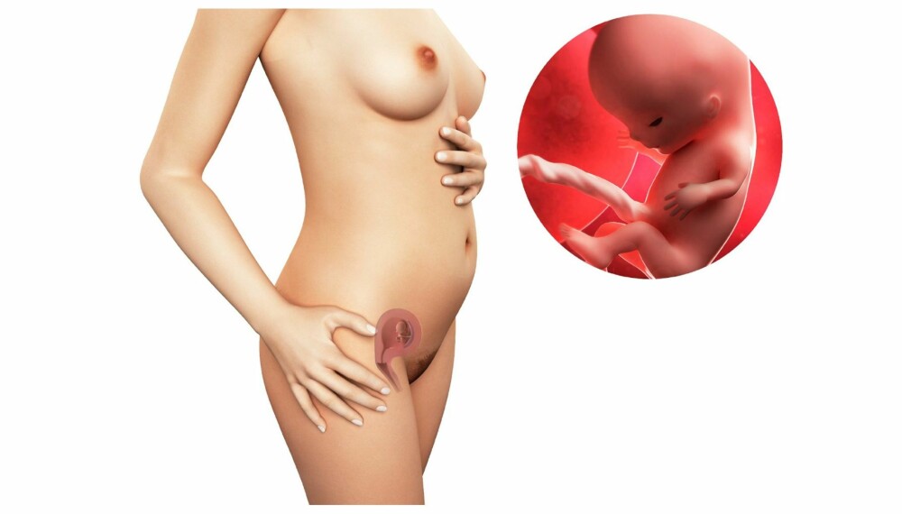 GRAVID UKE 11: Slik ser det ut i magen din etter elleve uker. GRAVID UKE 11: Slik ser det ut i magen din etter elleve uker.