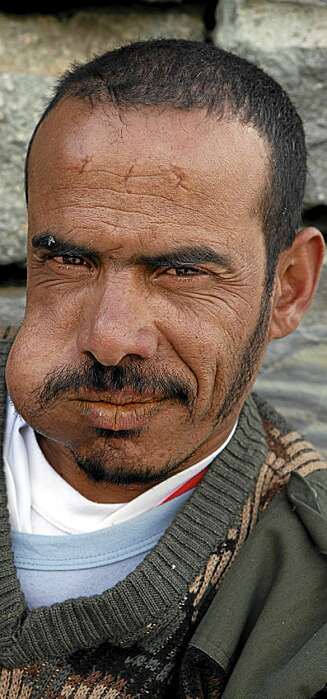 KJEVEN FULL: Mohammad med kjeven full av khat. KJEVEN FULL: Mohammad med kjeven full av khat.