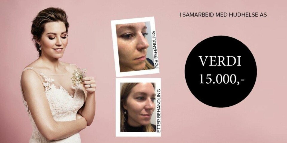 Ellinor Cummins (på bildet) vant fjorårets konkurranse med ZO Skin Health fra Dr. Obagi, og ble strålende fornøyd med resultatet! Ellinor Cummins (på bildet) vant fjorårets konkurranse med ZO Skin Health fra Dr. Obagi, og ble strålende fornøyd med resultatet!
