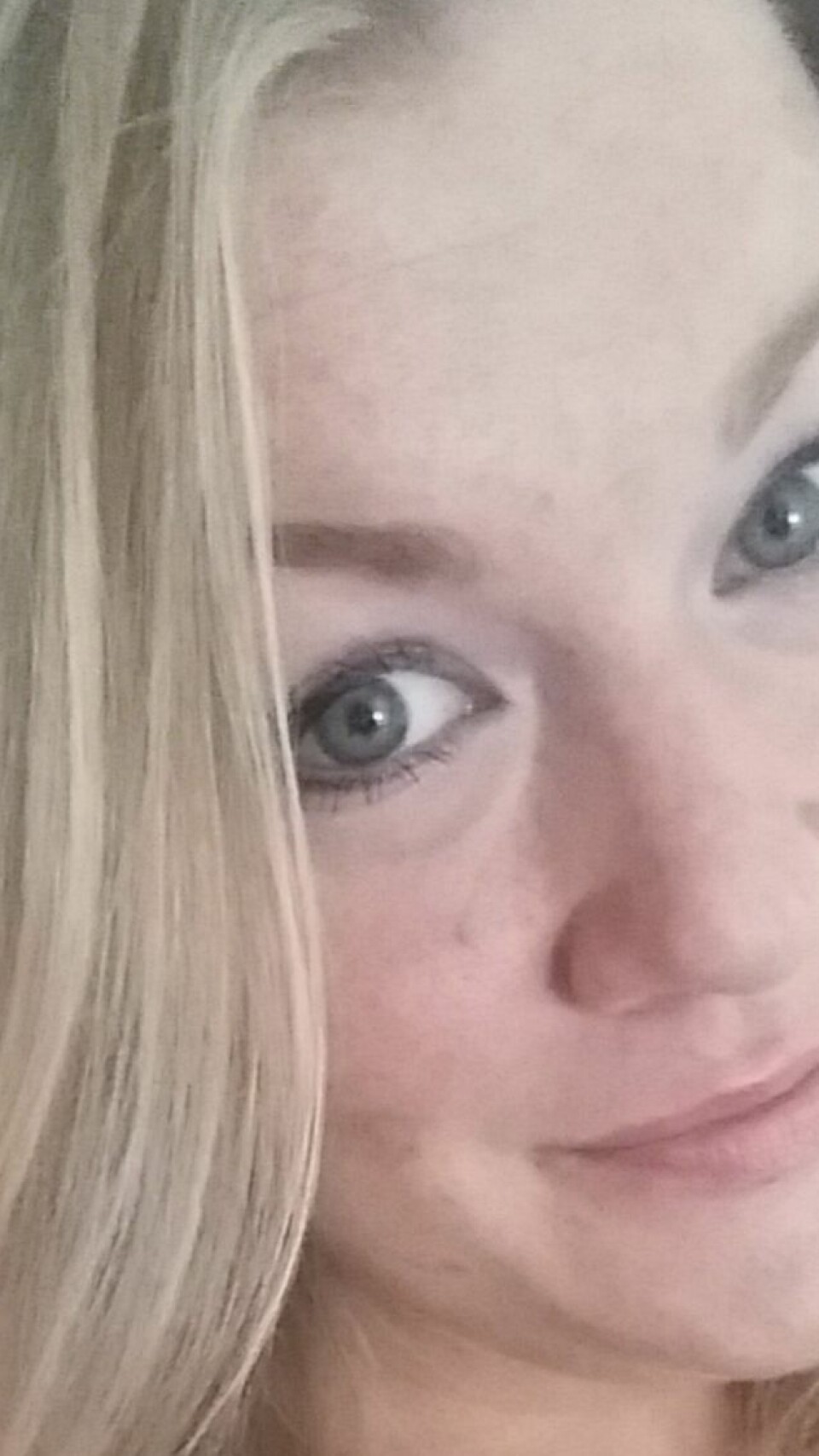 - Dette forteller jeg barna om arrene mine