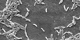 BAKTERIER I TEPPET: Dette er noe av bakteriene som kan tricevs i teppet ditt.