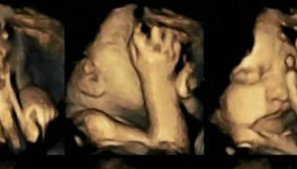 REAKSJON: Bildene viser fosteret i magen til en mor som røyker. 
