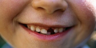 PRISEN PÅ EN MELKETANN: Det viser seg at det er store variasjoner på hva tannfeen bringer i bytte for en melketann. Hva ligger tannfetariffen på hjemme hos dere?