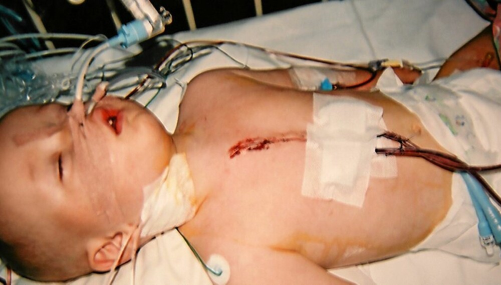 HULL I HJERTET: Her ligger William, 13 måneder gammel og nyoperert
på Rikshospitalet. Han var født med to hull i hjertet.