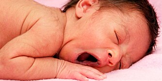 Closeup of a one week old baby yawning in her sleep(note the fine hairs called lanugo on the shoulders, cheeks and forehead, this is most noticable in premature infants)