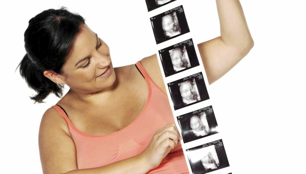 BILDER FRA ULTRALYD: Noen synes det er koselig å se på ultralydbildene dine. Men se an venninnen før du begynner å tegne og forklare femten bilder fra ultralyden. BILDER FRA ULTRALYD: Noen synes det er koselig å se på ultralydbildene dine. Men se an venninnen før du begynner å tegne og forklare femten bilder fra ultralyden.
