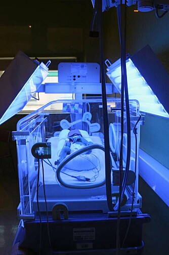 I KUVØSE: Som mange premature har Armand gulsott. Varmelamper gjør det godt og varmt i kuvøsen. I KUVØSE: Som mange premature har Armand gulsott. Varmelamper gjør det godt og varmt i kuvøsen.