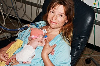 Jonas på sykehuset 23 dager gammel. 