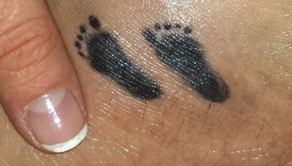 SMÅ FOTSPOR: Ida Maries Berentsen har tatovert fotavtrykket til sin bittelille sønn på ankelen. Gutten måtte aborteres etter 18 uker i morens mage.