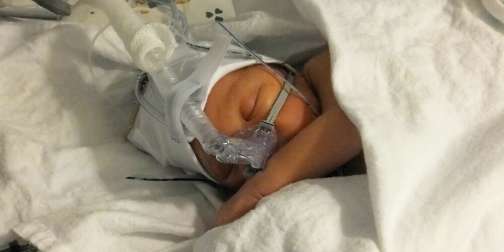 DRAMATISK: Her er Tobias to timer etter fødselen.