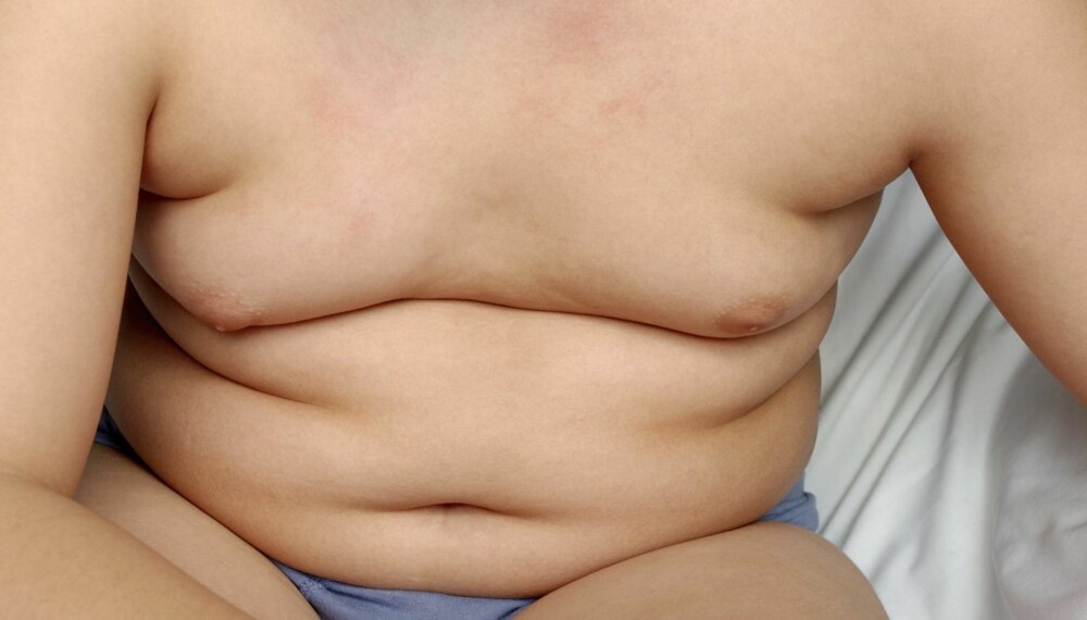 OVERVEKTIG SOM VOKSEN?: En ny kalkulator skal kunne beregne risikoen for at babyen din kommer til å bli overvektig i voksen alder. Foto: FOTO: Thinkstock.com OVERVEKTIG SOM VOKSEN?: En ny kalkulator skal kunne beregne risikoen for at babyen din kommer til å bli overvektig i voksen alder. Foto: FOTO: Thinkstock.com
