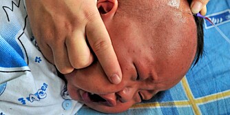 Mao Yongjie, er ni måneder og lider av nyretsein på sykehus i Hefei,  i Anhui provinsen i Kina