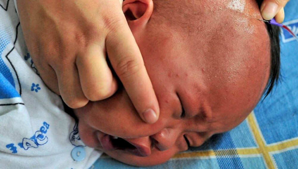 Mao Yongjie, er ni måneder og lider av nyretsein på sykehus i Hefei,  i Anhui provinsen i Kina