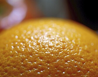 APPELSINHUD: Appelsinhud har fått navnet etter den fargesterke frukten. Det finnes hjelp!