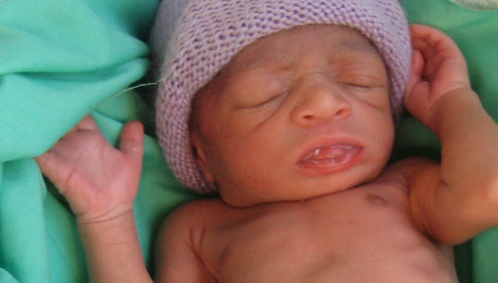 FØDSEL: Denne jenta veide 1600 gram da hun ble født. Moren hennes ankom sykehuset i trillebår. Utrolig nok overlevde både barnet og moren.