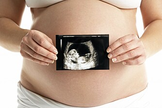 DRØMMEBARNET: Mange par sliter i årevis med å bli gravide. Organisasjonen To Hatch i England vil gi barnløse en sjanse til å blir foreldre ved å ta lodd i et IVF-lotteri.