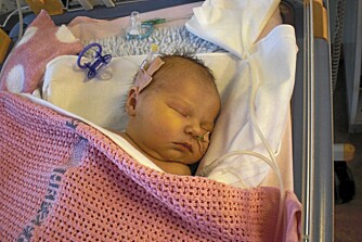 DØDELIG SYK: Elin var dødssyk ved fødselen, og etter 6 dager ble hun operert.