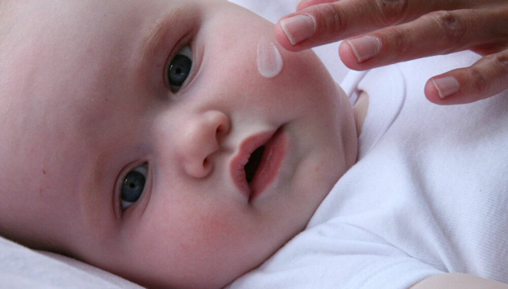 BABY MED TØRR HUD: Høsten og vinteren gjør tørr og ømfintlig hud enda tørrere. Da er det viktig å forebygge. BABY MED TØRR HUD: Høsten og vinteren gjør tørr og ømfintlig hud enda tørrere. Da er det viktig å forebygge.