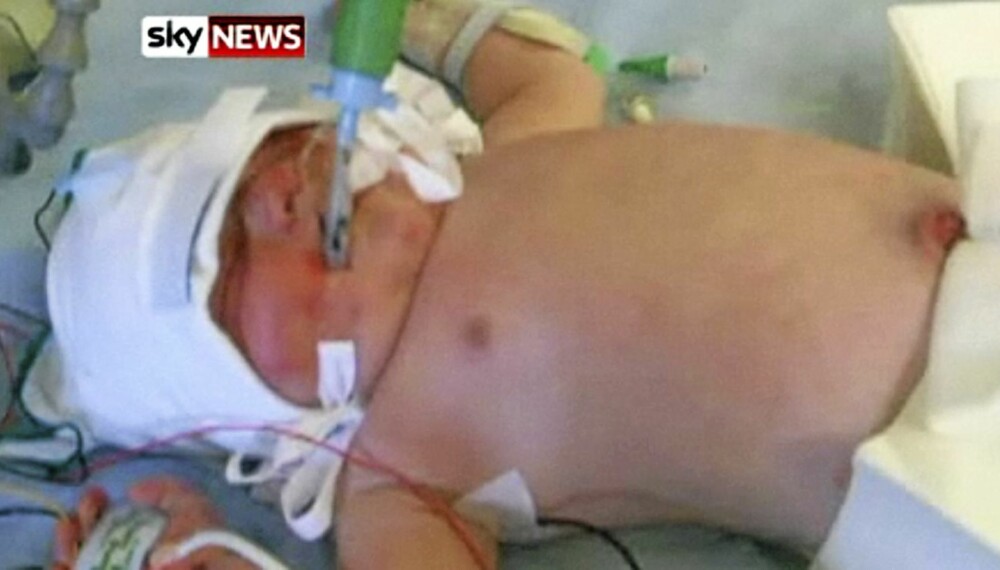 NEDKJØLT I 3 DØGN: Britiske Jamie Merricks ble kjølt ned i tre dager etter at hjernen hans fikk surstoffmangel under fødselen.