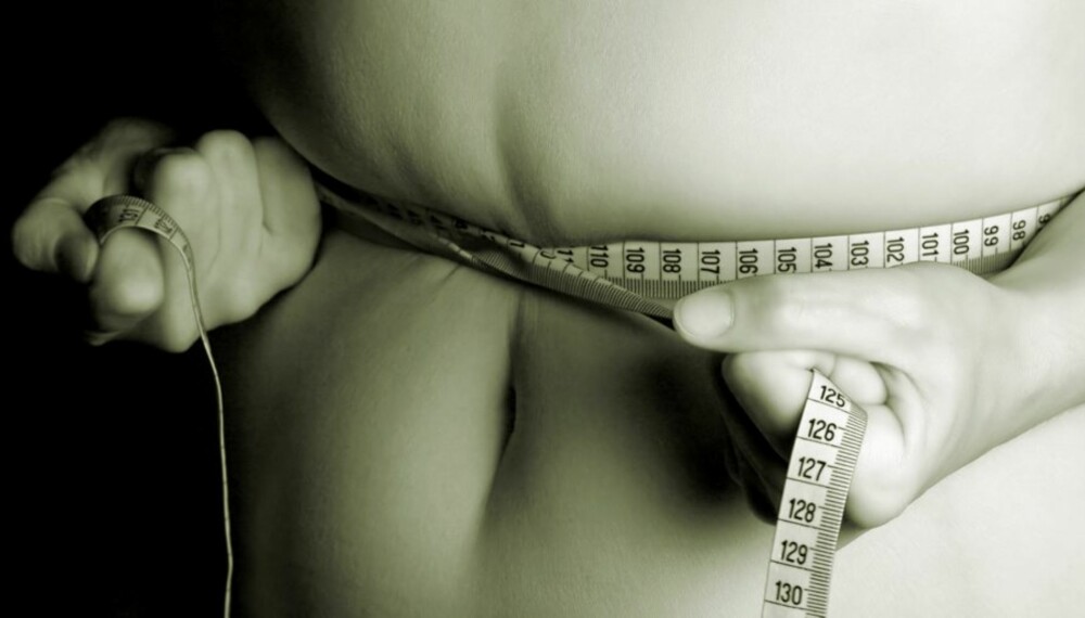 DYR OVERVEKT: Amerikanske forskere frykter at fedmeepidemien vil koste samfunnet en billion dollar.
