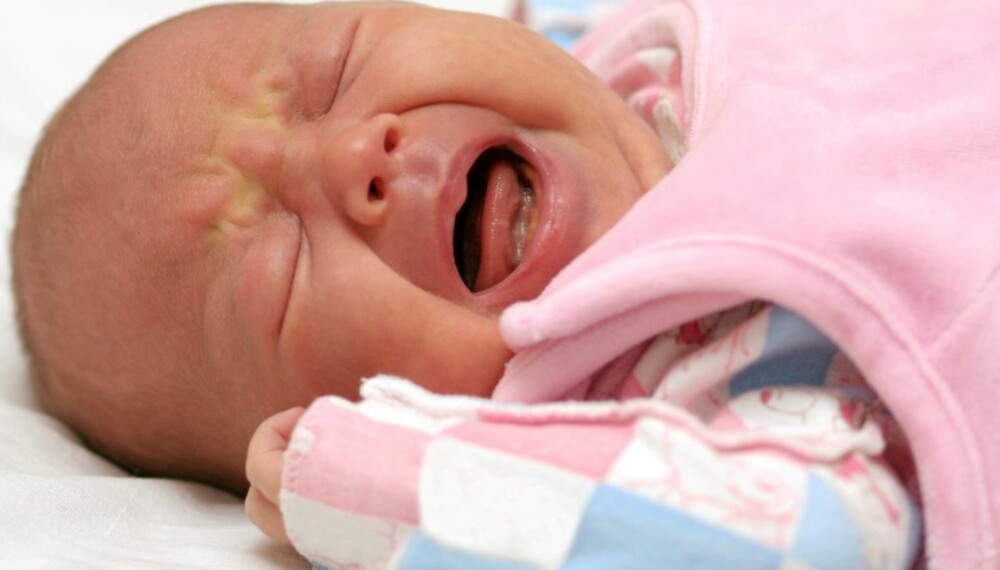 Ребенок родился в 6 месяцев. Младенческая дисхезия. Дисхезия новорожденных Комаровский. Младенческая дисхезия в 1 месяц. Младенческая дисхезия в 2 месяца.