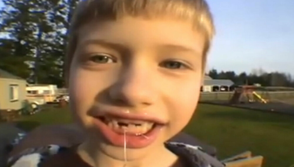 RAKETTFART: En lekerakett ble løsningen for denne amerikanske gutten. En relativt spektakulær tanntrekking.