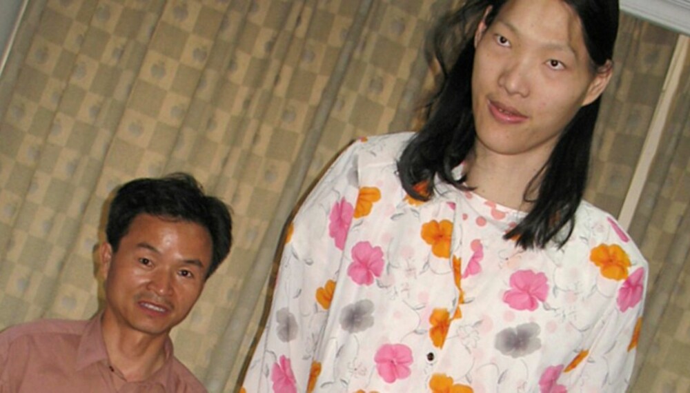 ASIATISK GIGANT: Kinesiske Yao Defen er 236 centimeter høy. Allerede ved 15 års alder raget hun 204 centimeter over bakken.