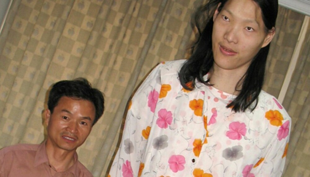 ASIATISK GIGANT: Kinesiske Yao Defen er 236 centimeter høy. Allerede ved 15 års alder raget hun 204 centimeter over bakken. ASIATISK GIGANT: Kinesiske Yao Defen er 236 centimeter høy. Allerede ved 15 års alder raget hun 204 centimeter over bakken.