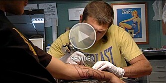 DYRT Å ANGRE: Å fjerne en tatovering på private klinikk kan fort komme opp i 10 000 kroner.