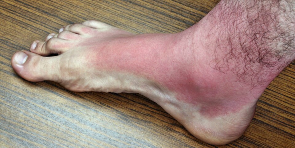 Nødhjelp når det virkelig svir