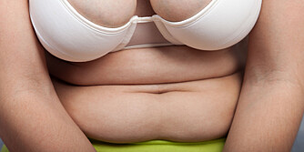 FARLIG FETT: Mye fett på magen regnes som ekstra farlig fordi det ofte knyttes til diabetes 2 og hjertesykdommer.