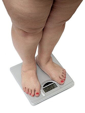 KROPPSMASSE: Etter forskriftene er Alli godkjent for personer med kroppsmasseindeks over 28. Grensa for fedme går ved 30.