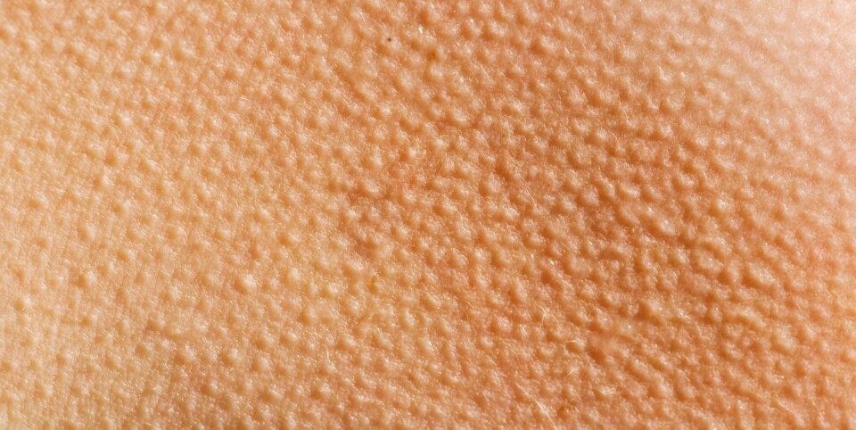 FØLSOM: Jo mer emosjonell man er, jo mer gåsehud får man sannsynligvis, ifølge hudlege Jon Langeland.