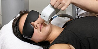 LASER: Gjentakende laserbehandlinger med IPL er en av mulighetene for å fjerne bart eller skjeggvekst.