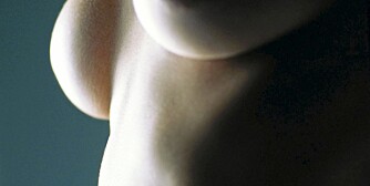 BRYSTFORSTØRRELSE: Et ikke uproblematisk alternativ til silikonproteser i brystene er fettvev fra andre kroppsdeler.