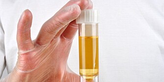 HELSESJEKK PÅ BADET: Urinen din kan si mye om helsetilstanden. Farge og lukt er noe av det du kan legge merke til selv.