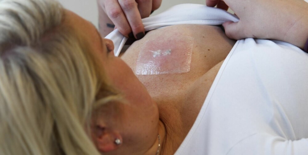 TID: Det er en langvarig prosess å fjerne en tatovering. Det kreves mange behandlinger, og mellom hver gang skal det gå tid slik at man unngår arr. TID: Det er en langvarig prosess å fjerne en tatovering. Det kreves mange behandlinger, og mellom hver gang skal det gå tid slik at man unngår arr.