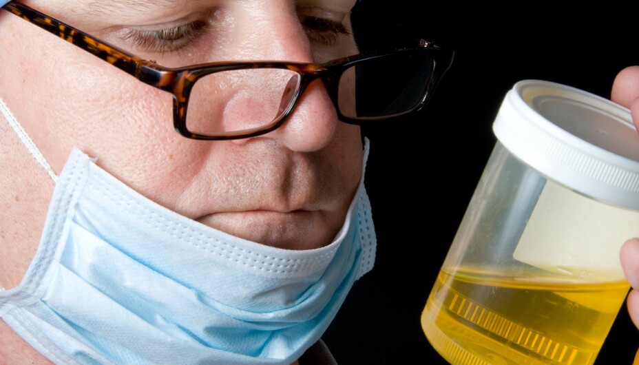 URINPRØVE: En urinprøve kan fortelle mye om helsen din, men da må du utføre den riktig. 
