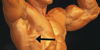 LITEN, MEN STOR: Serratus anterior er den sagtannede muskelen pilen peker på, og er en del av den store skulder- og ryggmuskulaturen. Anterior spiller en stor rolle for hva slags kroppsholdning du har.