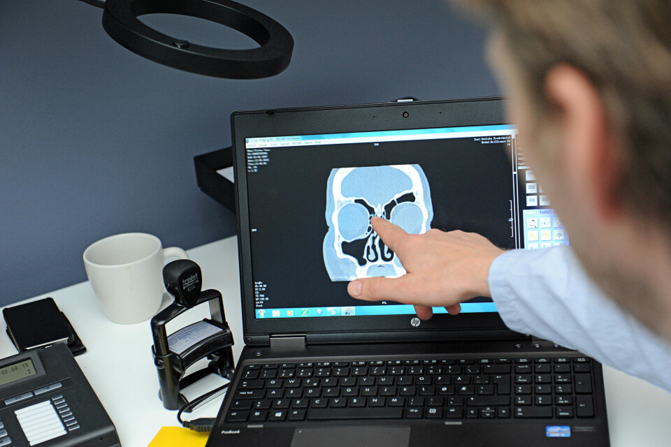 NYTTIGE CT-BILDER: CT-bildene avslører hvor og i hvilke bihuler forholdene er så trange at det kvalifiseres for operasjon. FOTO: Marianne Otterdahl-Jensen