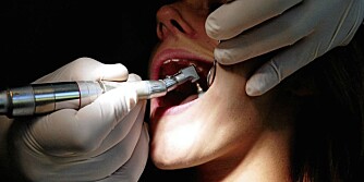 UNDERSØKELSE: Det har vist seg at de som fikk profesjonell tannrens minst to ganger i året i løpet av to år, reduserte risikoen for hjerteinfarkt med 24 prosent.